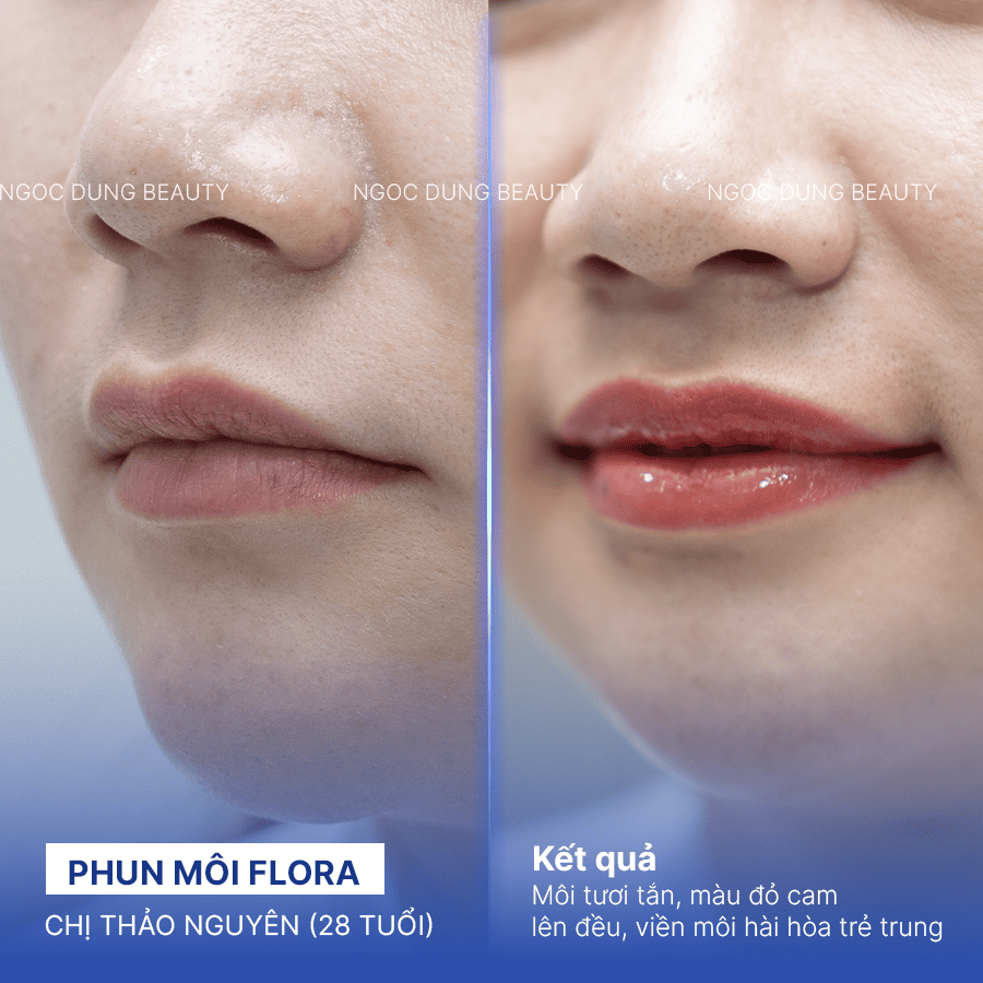 Before/ After Phun môi