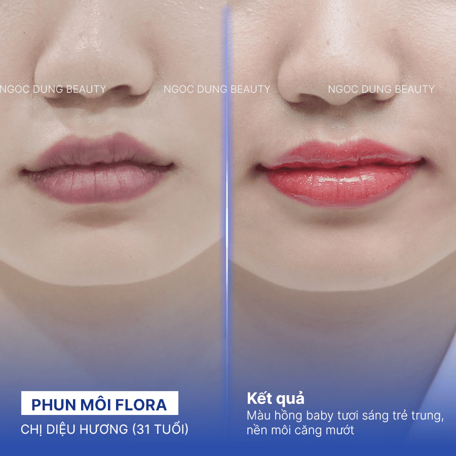 Before/ After Phun môi