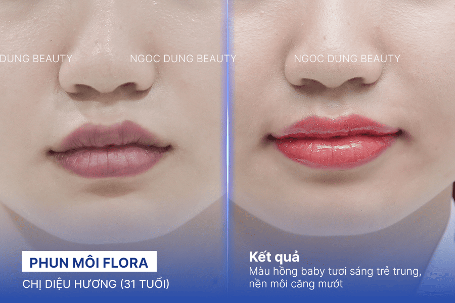 Before/ After Phun môi