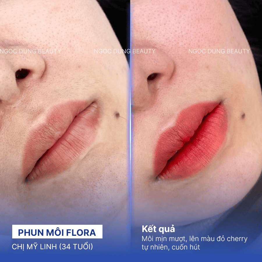 Before/ After Phun môi