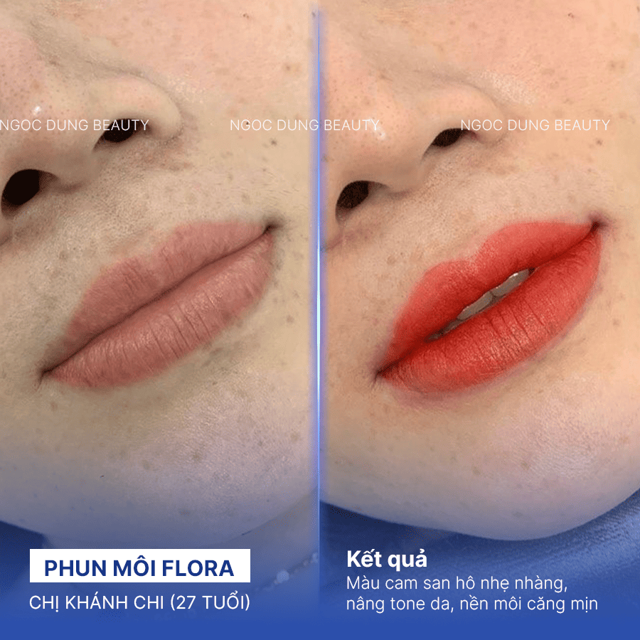 Before/ After Phun môi