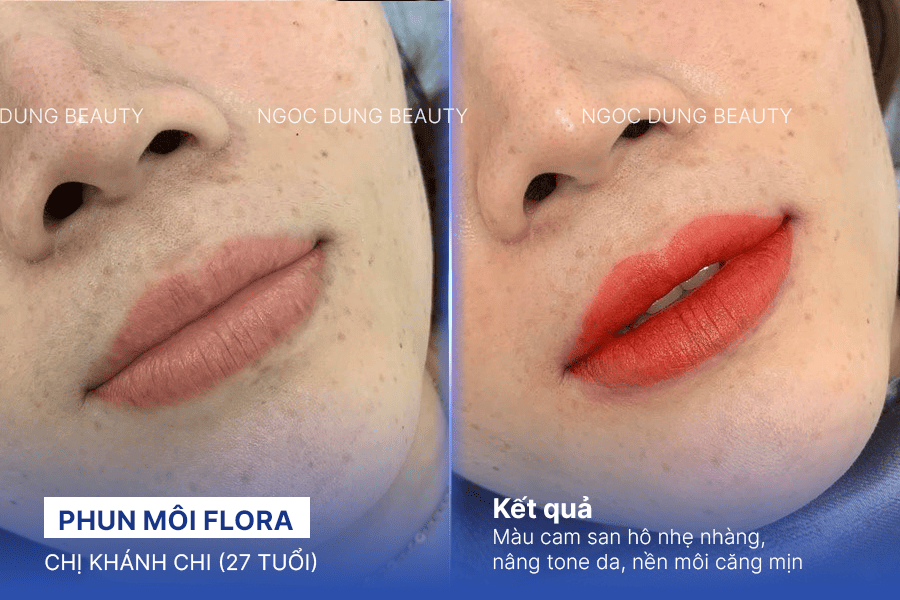 Before/ After Phun môi