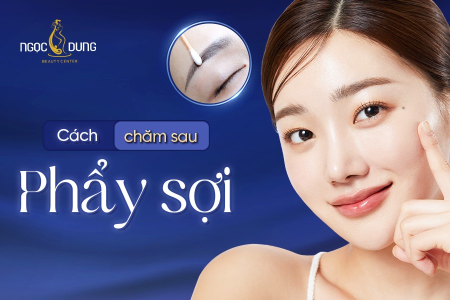 chăm sóc sau phẩy sợi