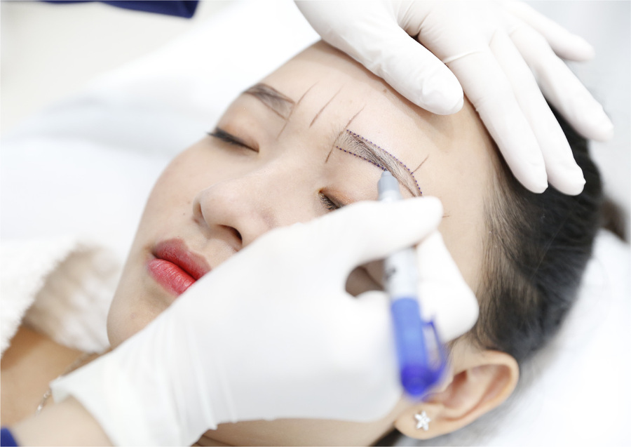 20 câu hỏi phổ biến nhất về phẩy sợi mày