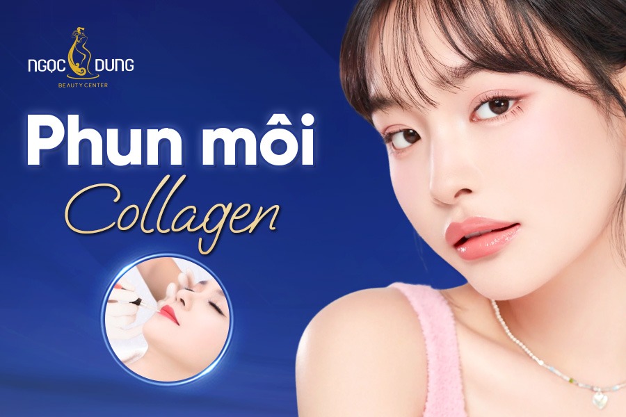 Phun môi collagen: Ưu, nhược điểm và những lưu ý
