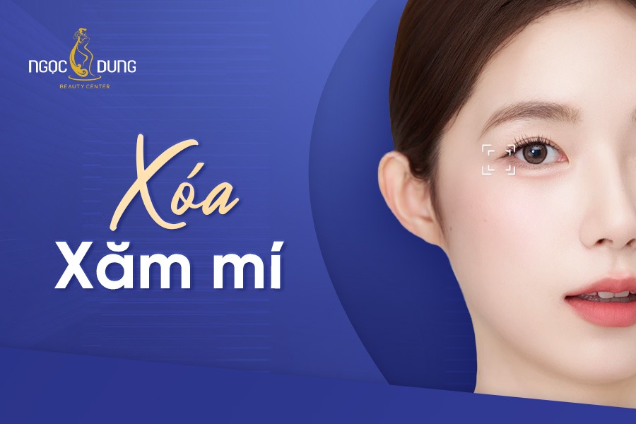 Xóa xăm mí mắt