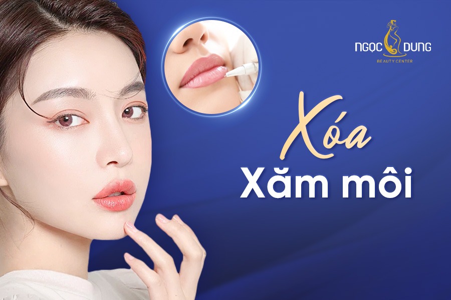 Xóa xăm môi