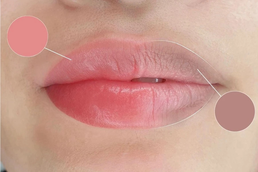 Khử thâm môi là một giải pháp loại bỏ các vấn đề về màu môi bị xỉn