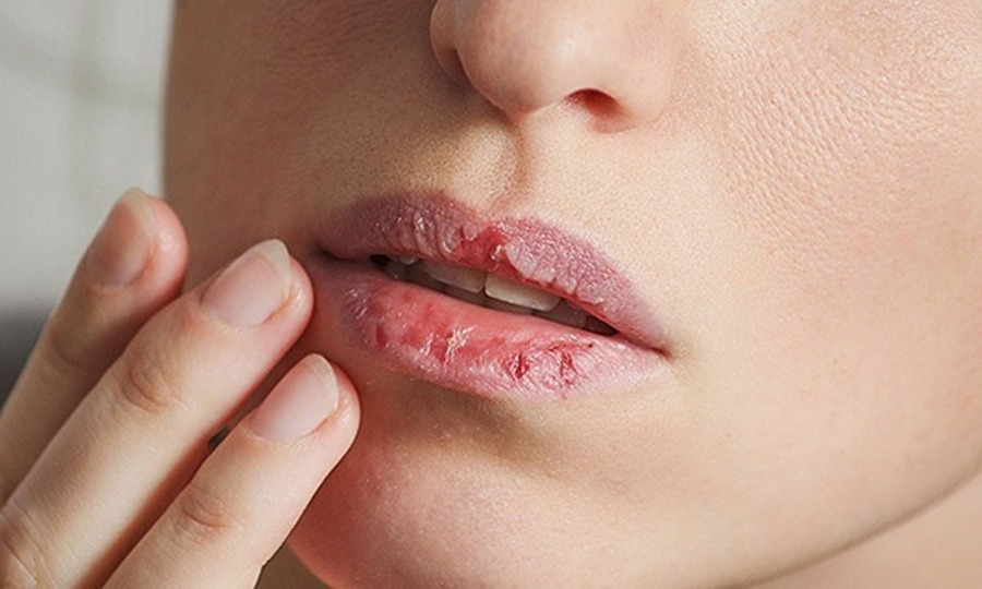 Phun môi tế bào gốc phù hợp với nhiều đối tượng khác nhau